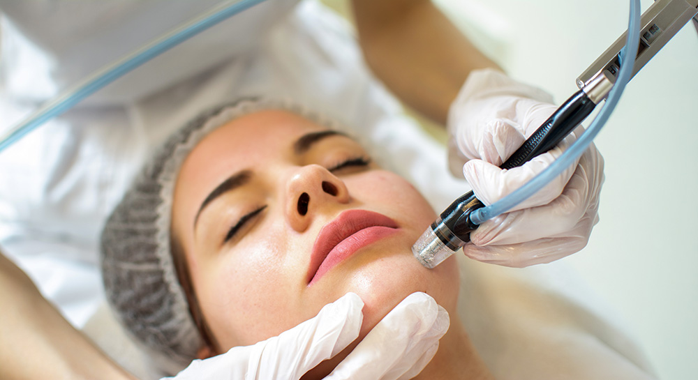 What Is Microdermabrasion?